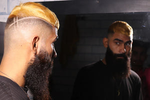 Navigating Social Stigma Surrounding Hair Loss
