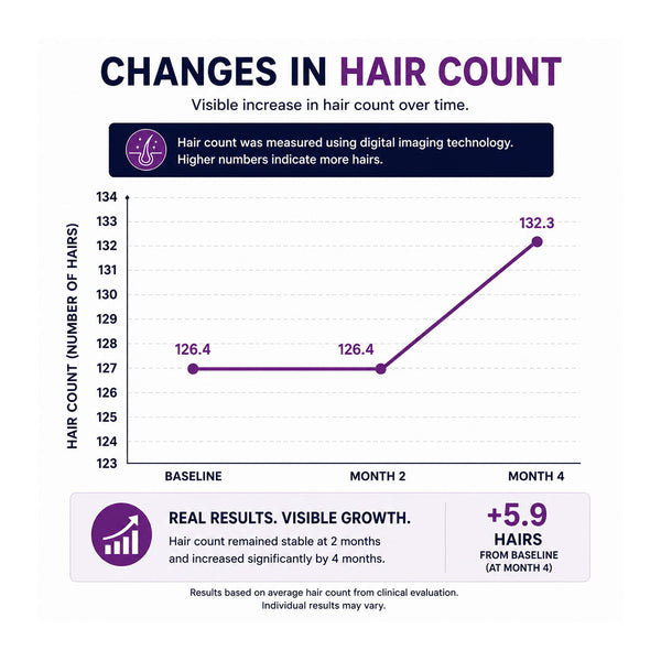 FOLIGAIN® Triple Action Conditioner For Thinning Hair For Women with 2% TRIOXIDIL®
