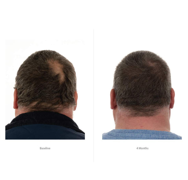 FOLIGAIN 男士生发洗发水 + 护发素套装